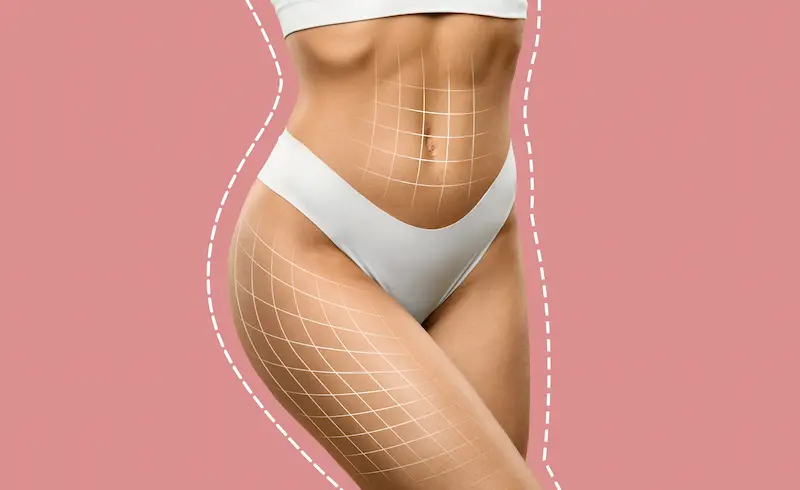 360 Liposuction