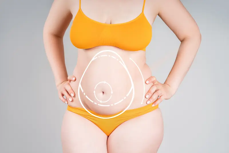 Abdomen Lipo Cost Turkey