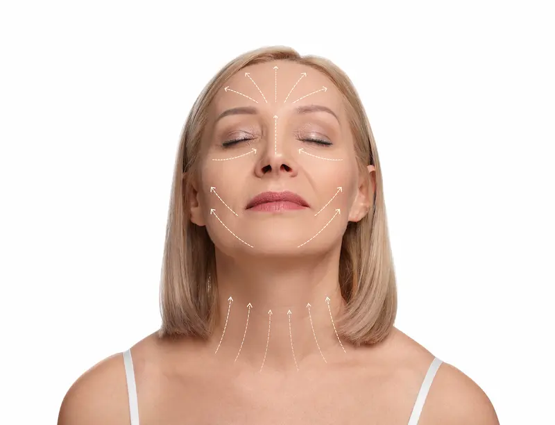 Awake Face and Neck Lift