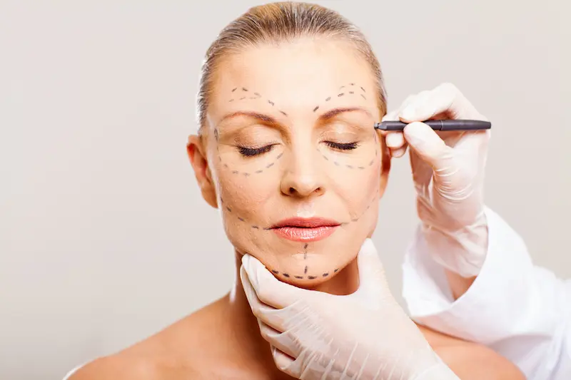 Deep Plane Face Lift in Turkey