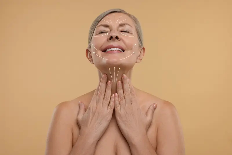 Face and Neck Lift Surgery