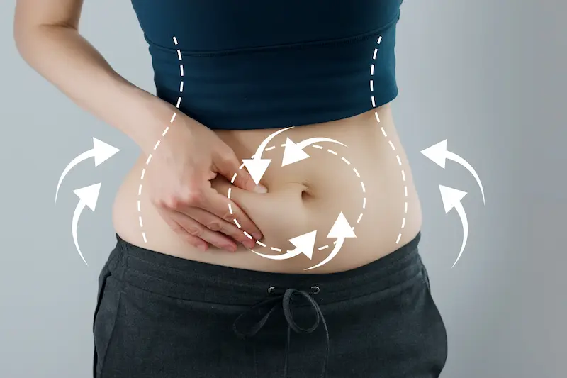 Tummy Tuck (Abdominoplasty)